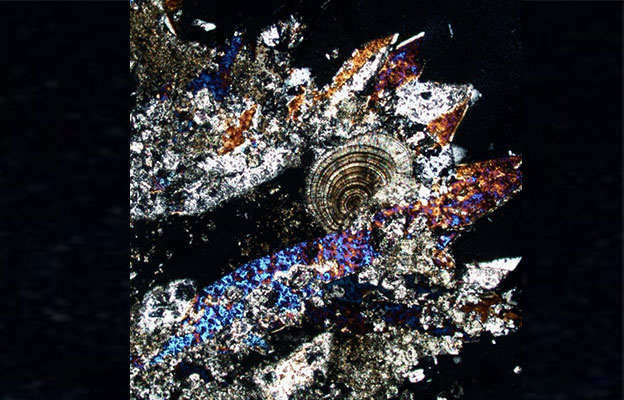 如银河般璀璨的尿路结石晶体：应用陨石研究方法解读人体内部环境