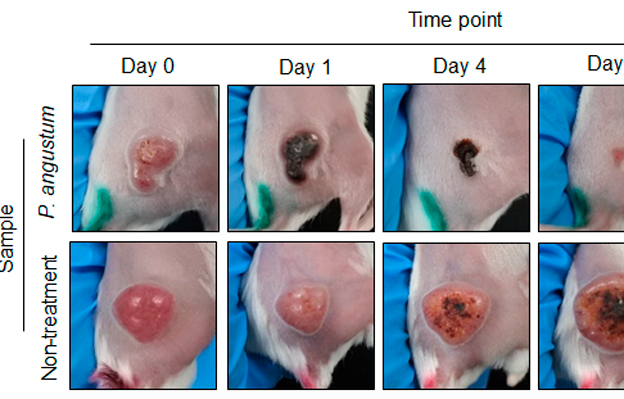 北陆先端科学技术大学院大学发现无需基因改造的海洋细菌可选择性攻击大肠癌，治疗效果显著