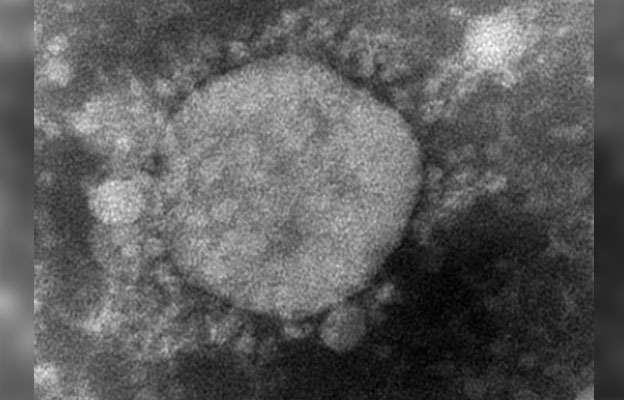 日本新冠死亡人数居高不下 累计逾15.8万人