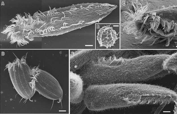 岛根大学等成功仅用水的冷冻干燥法实现生物样品的SEM观察的新方法，避免细胞损伤