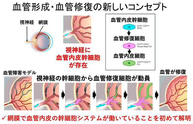大阪大学通过小鼠实验发现视神经内修复视网膜血管的干细胞