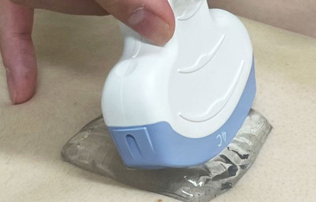 近畿大学开发出超声检查用固态凝胶垫，与液体凝胶同效但不黏腻