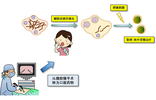 顺天堂大学开发出新型不孕症治疗方法：口服肾病药物“非奈利酮”对早发闭经有效