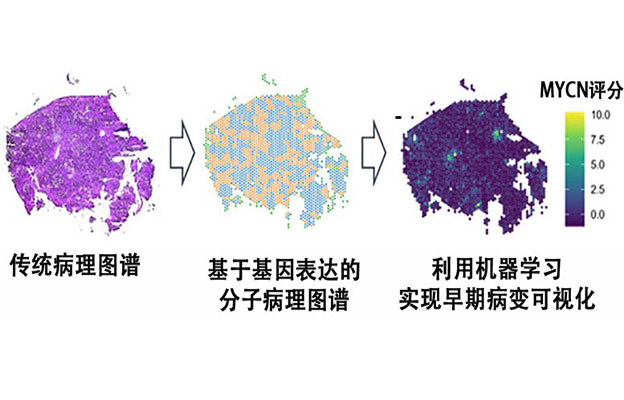 理研等预测肝癌发病风险，MYCN基因表达可作为指标