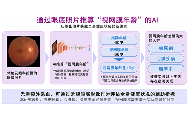 日本东北大学的AI技术，仅用一张眼底照片即可推算出反映身体年龄的“视网膜年龄”