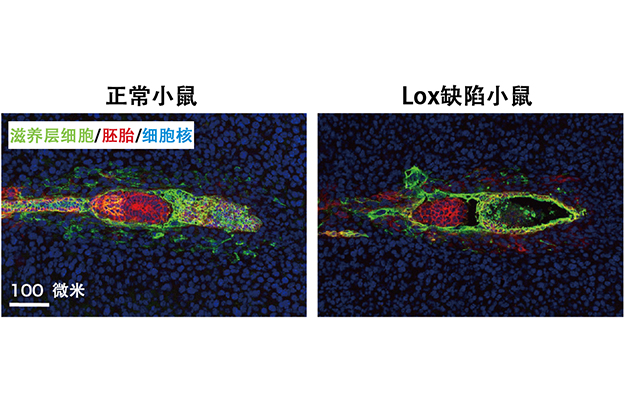 筑波大学学者发现促进胚胎着床后发育与胎盘形成的关键酶，为不孕症机制研究与治疗思路提供新线索