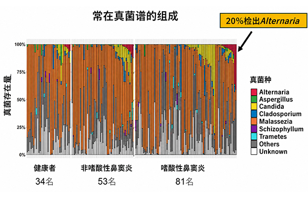 福井大与筑波大发现真菌参与嗜酸性鼻窦炎恶化，感染链格孢菌复发风险升至2.8倍