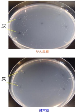 日本九州大学研究小组利用线虫用一滴尿液试料诊断癌症