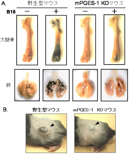 日本研究发现利用前列腺素E可控制癌细胞转移