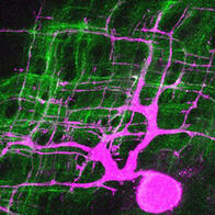 冈山大学等将真皮中编织胶原蛋白的细胞形态可视化