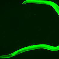 给“寄生虫”涂膜，大阪大学欲利用异尖线虫治疗癌症