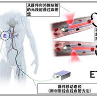 名古屋大学研发出可照射到体内深处的光学器件，有助于近红外线免疫疗法等癌症治疗技术