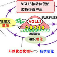 九州大学发现VGLL3蛋白促使脏器变硬纤维化