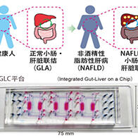 京都大学开发出模拟非酒精性脂肪性肝的肠肝脏器模式芯片