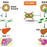 京都大学发现膜蛋白“RECK”的表达减少会导致胰腺癌症状恶化
