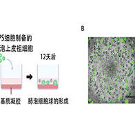 京都大学iPS细胞研究所确定促进I型肺泡上皮细胞分化的信号通路，有望推动肺部疾病治疗药物的开发