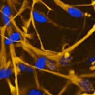 理研利用iPS高效制备“神经胶质细胞”，治疗ALS等难治性神经疾病的关键