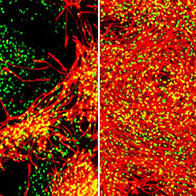 大阪大学开发出适用于临床的iPS细胞制作肌肉干细胞的制备方法