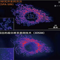 大阪大学开发出抑制背景光的超分辨率显微技术,可观察迷你器官“类器官”的内部