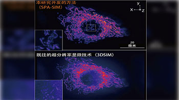 大阪大学开发出抑制背景光的超分辨率显微技术,可观察迷你器官“类器官”的内部