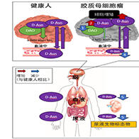 通过尿检早期诊断恶性脑肿瘤，金泽大学发现新型生物标志物