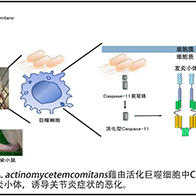 东京医科齿科大学明确牙周致病菌加剧关节炎的生理机制