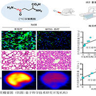 非酒精性脂肪性肝炎可视化诊断迎来突破性进展：QST团队开发成功新型[11C]谷氨酰胺分子探针，助力PET影像无创诊断与疗效评估