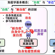 大阪大学成功解明系统性自身免疫性疾病发病机制：T细胞对“自我”与“新自我”的识别能力是致病原因