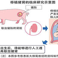 为了向肾病胎儿移植猪肾，慈惠医大开始内审