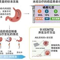 NIBIOHN与国立癌研通过高精度磷酸化信号解析确定胃癌治疗靶点，同时明确胃癌在治疗过程恶化的情况