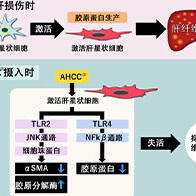 大阪公立大学发现香菇提取物有可能抑制肝纤维化的进展