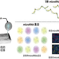 东京科学大学等利用尿液外泌体微RNA分析实现早期癌症检测