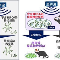 QST等发现用超声波刺激提高脑活动的脑内传感器，有望用于治疗神经退行性疾病和抑郁症