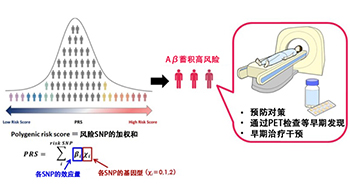 庆应义塾大学医学部和卫材、实现脑内β-淀粉样蛋白蓄积风险的可预测，便于掌握阿尔茨海默病的发病风险