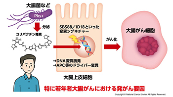 日本国立癌症研究中心：约半数大肠癌或与肠道菌群相关，分泌毒素会引发特定基因突变