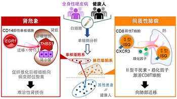 大阪大学发现通过白细胞的单细胞分析可预测罕见病“全身性硬皮病”的致命性重症