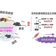 京都府立大学发现：“多胺”合成缺陷或为肌肉萎缩原因