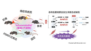 京都府立大学发现：“多胺”合成缺陷或为肌肉萎缩原因