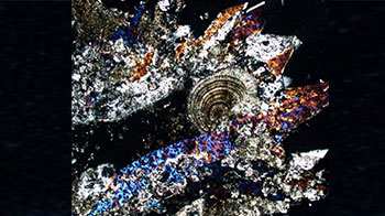 如银河般璀璨的尿路结石晶体：应用陨石研究方法解读人体内部环境