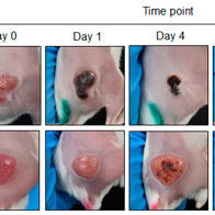 北陆先端科学技术大学院大学发现无需基因改造的海洋细菌可选择性攻击大肠癌，治疗效果显著
