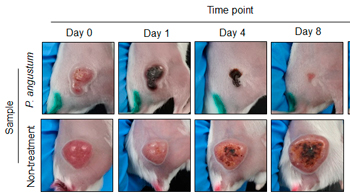 北陆先端科学技术大学院大学发现无需基因改造的海洋细菌可选择性攻击大肠癌，治疗效果显著