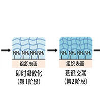 新型水凝胶可预防肝切除术后胆汁渗漏：瞬时凝固止血，长期稳定黏附