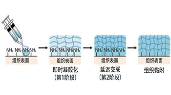 新型水凝胶可预防肝切除术后胆汁渗漏：瞬时凝固止血，长期稳定黏附