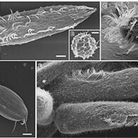 岛根大学等成功仅用水的冷冻干燥法实现生物样品的SEM观察的新方法，避免细胞损伤