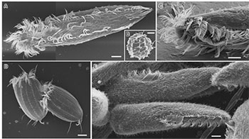 岛根大学等成功仅用水的冷冻干燥法实现生物样品的SEM观察的新方法，避免细胞损伤