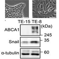 九州大学等阐明脂质代谢失衡会导致抗癌药难以收效的分子机制 为开拓新治疗策略开辟道路