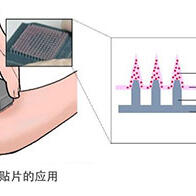 东京大学开发出新冠疫苗微针贴片，旨在实现自我接种和常温运输
