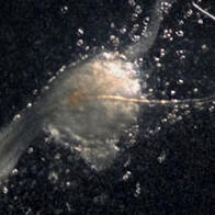 理研等发现生发的“第三种细胞”，助力脱发症新型疗法