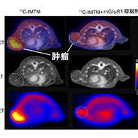 QST开发出兼具诊断与治疗的药剂，单次给药即可对原发灶和转移灶产生肿瘤抑制效果