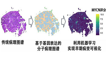 理研等预测肝癌发病风险，MYCN基因表达可作为指标